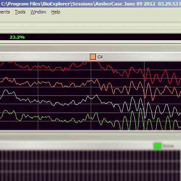 Transition-from-noise-to-alpha-synchrony.jpg